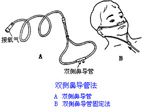 ◆肺病患者如何家庭氧療？